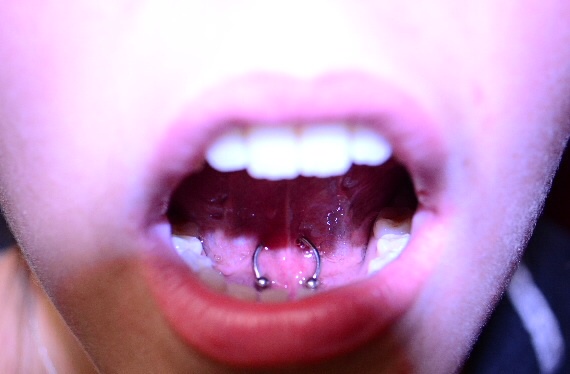 A close up of the mouth with two piercings