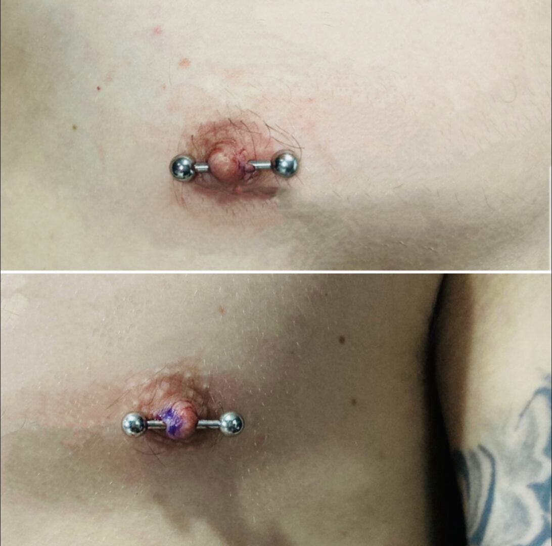 A before and after picture of the piercing process.