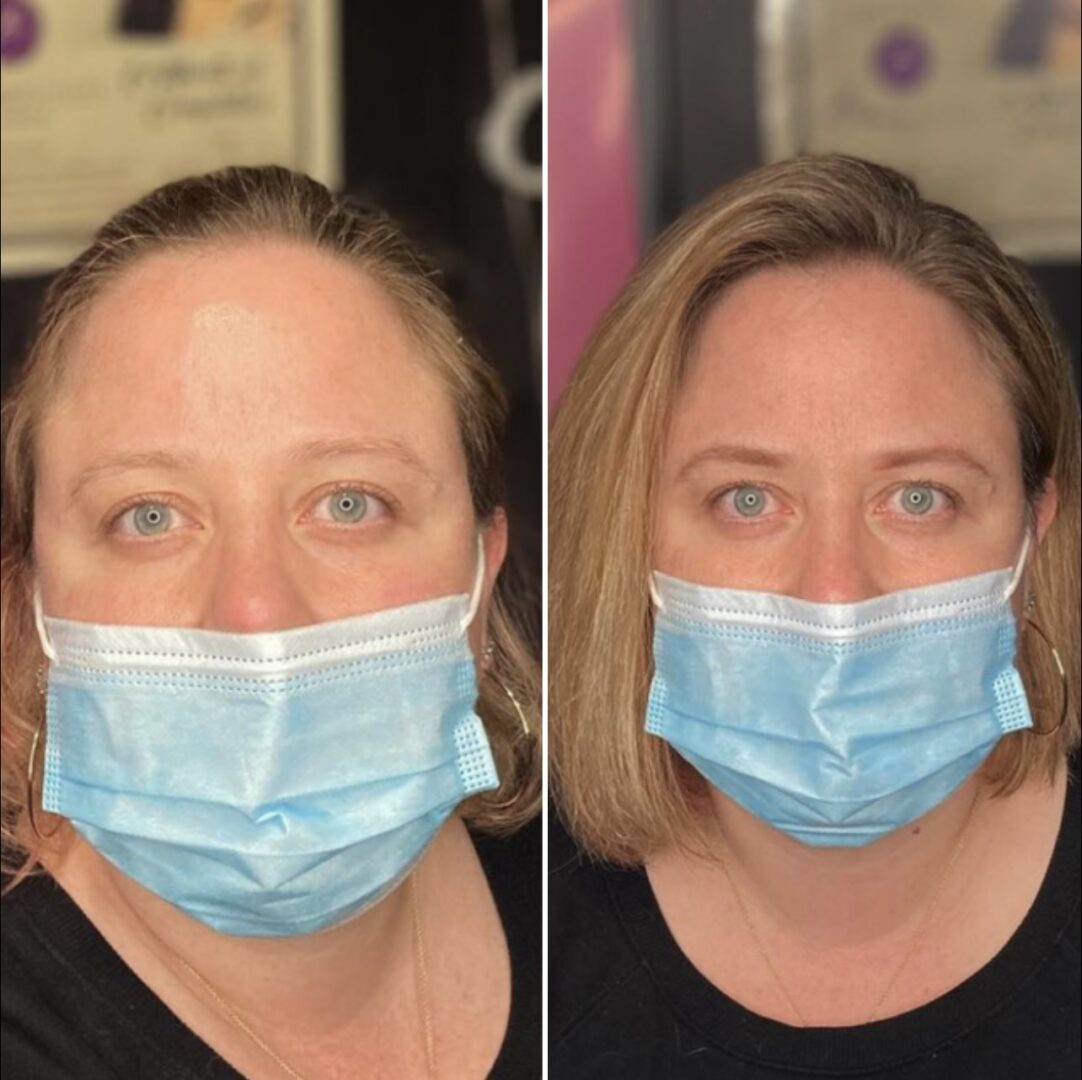 A before and after photo of a woman with surgical mask on.
