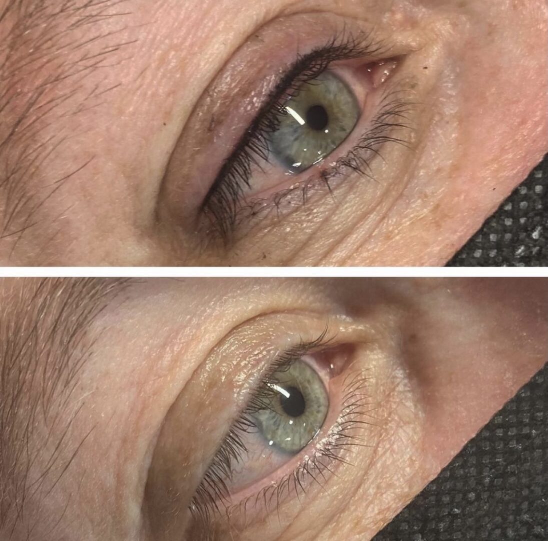 A before and after photo of the eyes of an older woman.
